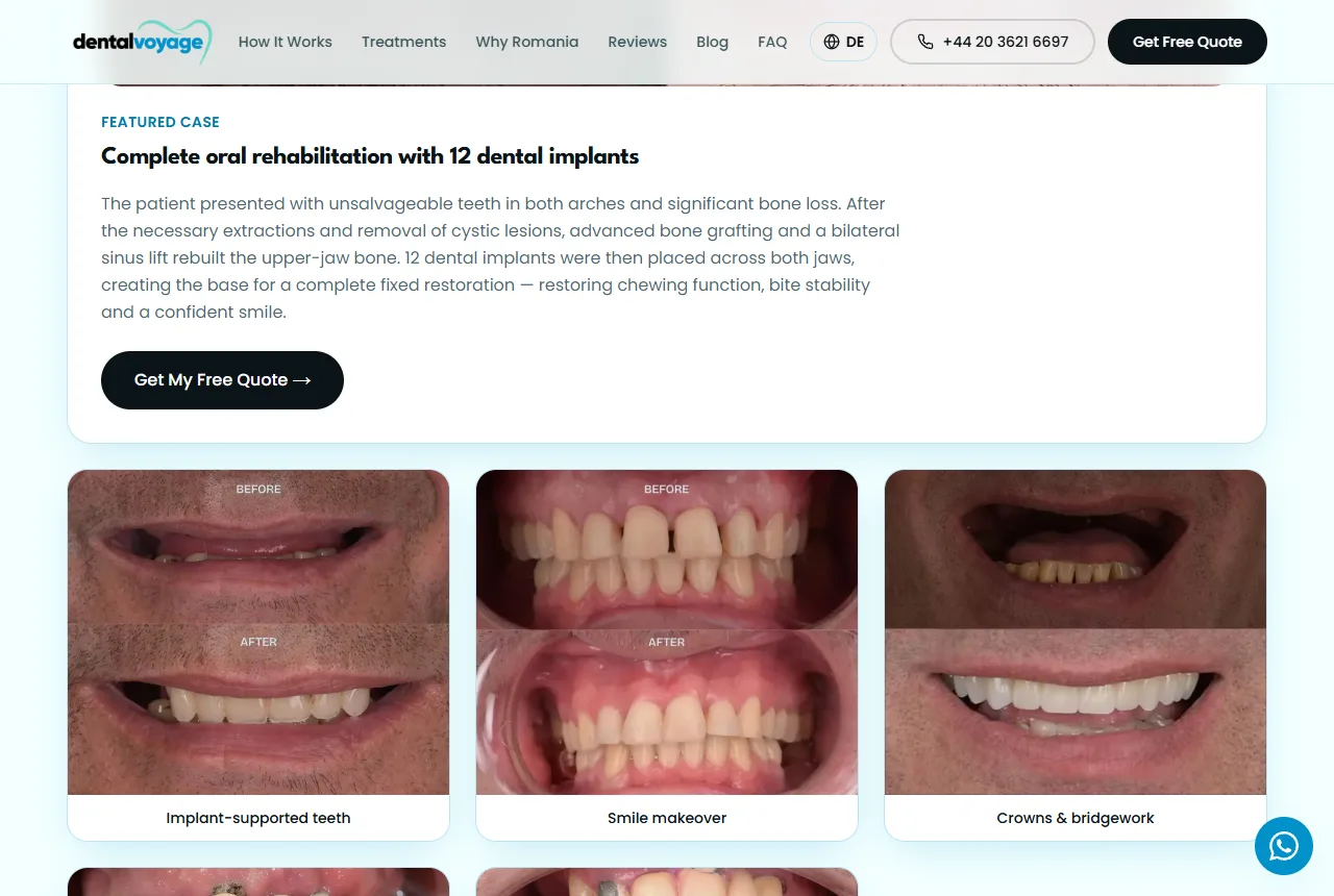 Dental Voyage — The cost comparator: the Romania estimate placed directly beside UK private fees.